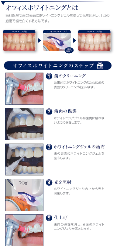 当院のオフィスホワイトニングについて